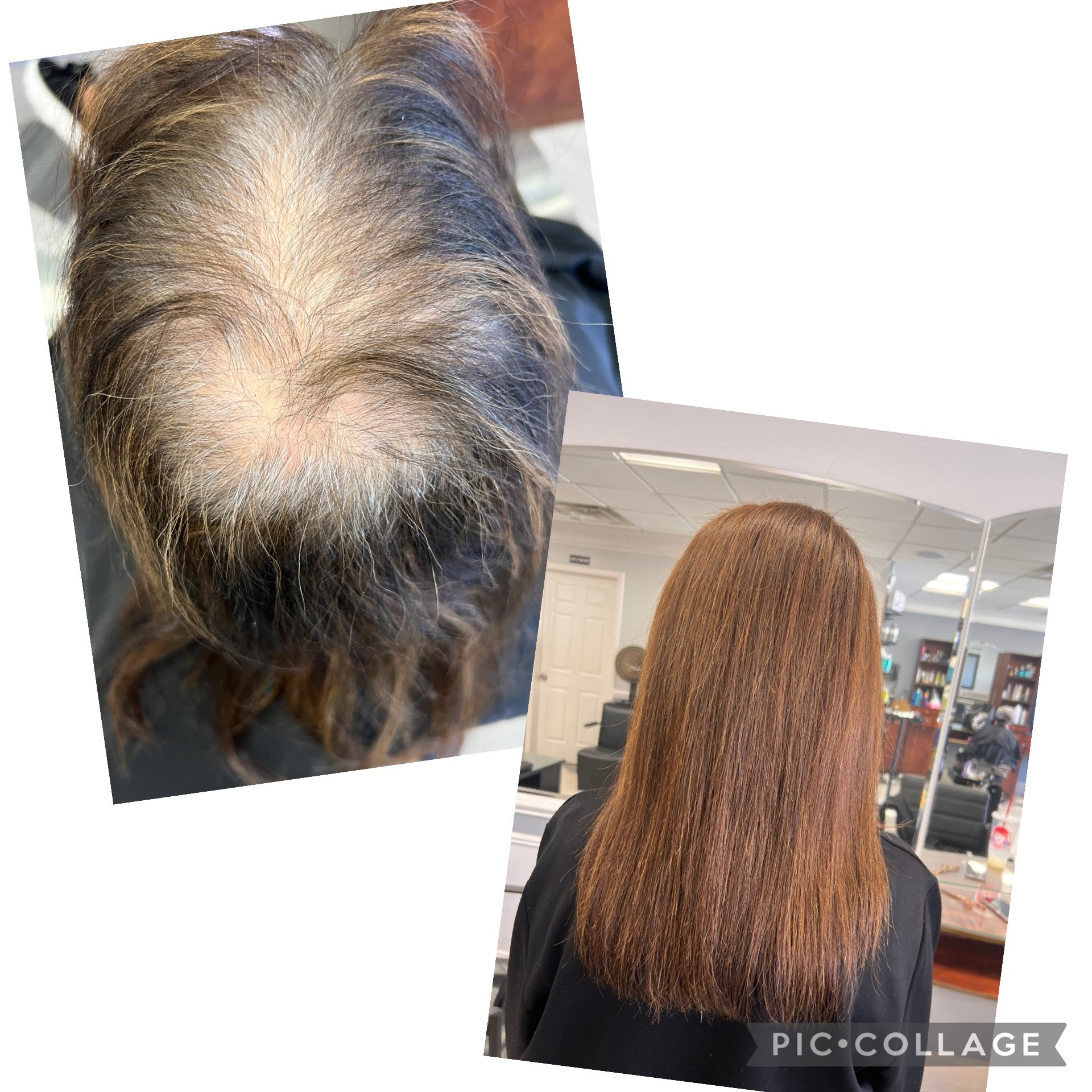 Hair thinning before and after treatment.