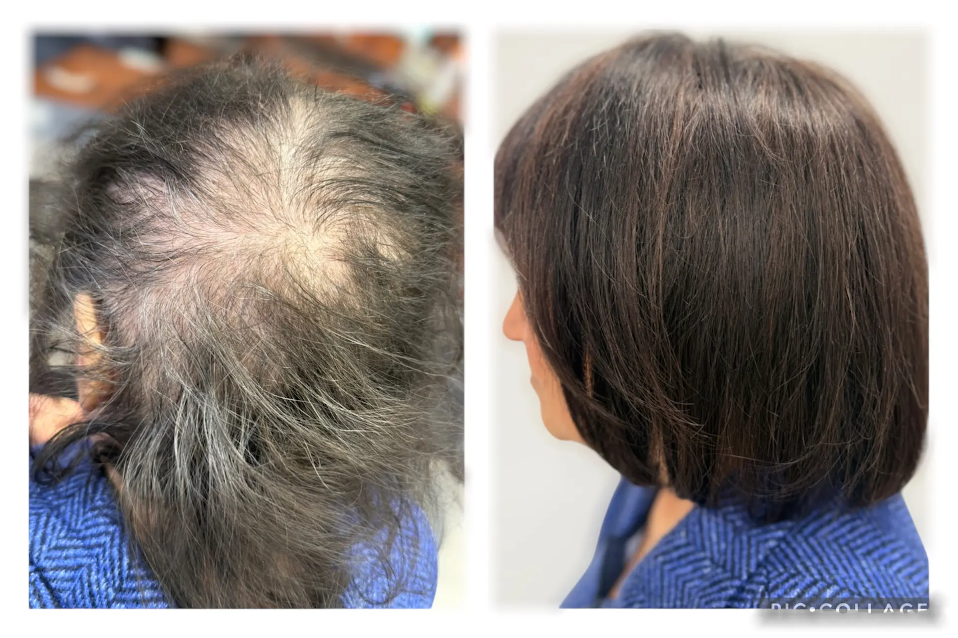 Hair loss before and after treatment.